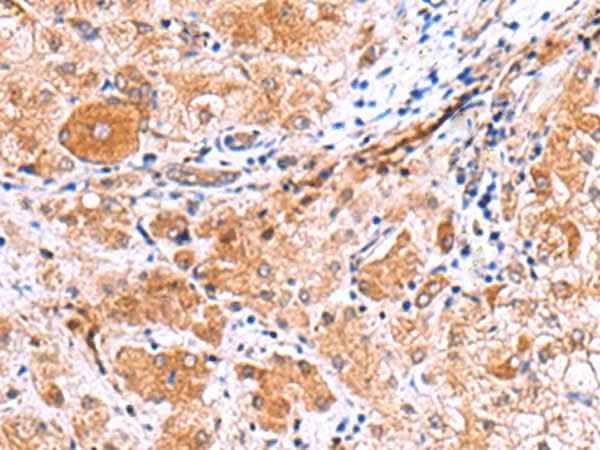 Anti-Human/Rat IRGC Antibody