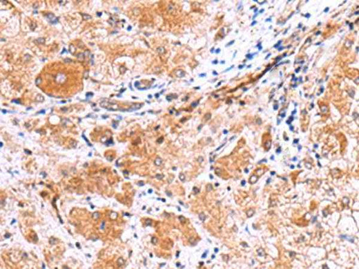 Anti-Human/Rat IRGC Antibody