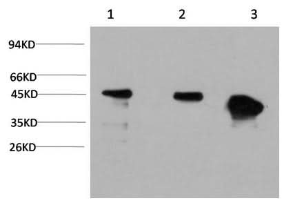 Anti-Human/Mouse/Rat GSK3 beta Antibody [4D2] - ABMIUM