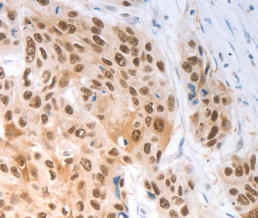 Anti-Human SLC22A8 Antibody - ABMIUM