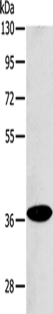 Anti-Human/Mouse ACMSD Antibody - ABMIUM