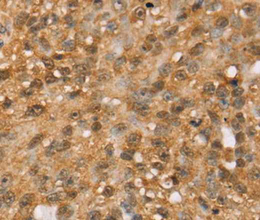 Anti-Human/Mouse/Rat MED22 Antibody