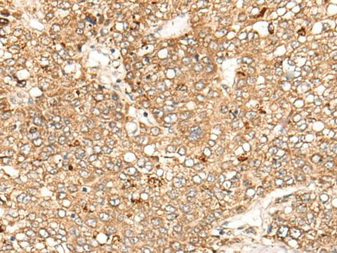 Anti-Human C1S Antibody - ABMIUM
