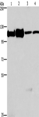 Anti-Human/Mouse/Rat MCM6 Antibody - ABMIUM