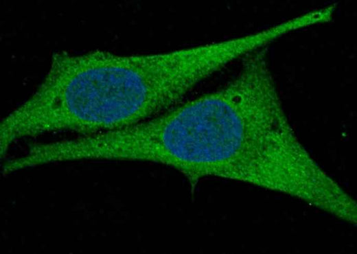 Anti-Human AK2 Antibody [A1232] - ABMIUM