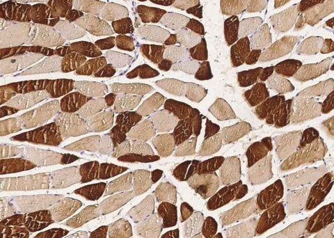 Anti-Human ENO3 Antibody [A1210] - ABMIUM