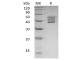 Recombinant Human FCRL1 Protein (His Tag) - ABMIUM