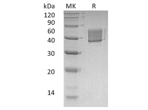 Recombinant Human FCRL1 Protein (His Tag) - ABMIUM