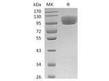 Recombinant Human ROBO4 Protein (Fc Tag) - ABMIUM