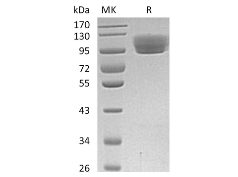 Recombinant Human ROBO4 Protein (Fc Tag) - ABMIUM