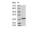 Recombinant HIV-1 p24 protein (group N, strain 06CM-U14296) (His Tag) - ABMIUM