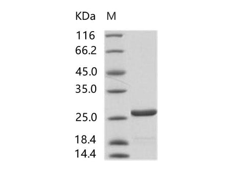 Recombinant HIV-1 p24 protein (group N, strain 06CM-U14296) (His Tag) - ABMIUM