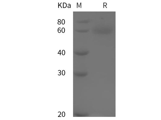 SDS-PAGE analysis of Rat Antithrombin-III/Serpinc1 proteins, 2 μg/lane of Recombinant Rat Antithrombin-III/Serpinc1 proteins was resolved with SDS-PAGE under reducing conditions, showing bands at 60 kDa.