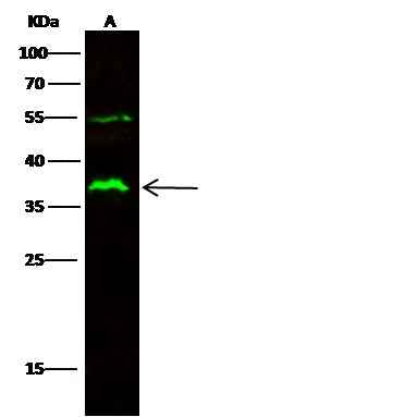 Anti-Human FCGR2A Antibody [B250] - ABMIUM