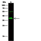 Anti-Human FCGR2A Antibody [B250]