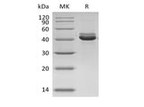 SDS-PAGE analysis of Human CD5L/hAIM proteins, 2 μg/lane of Recombinant Human CD5L/hAIM proteins was resolved with SDS-PAGE under reducing conditions, showing bands at 42 kDa.