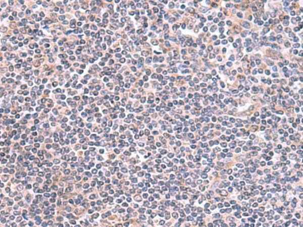 Anti-Human/Mouse GMDS Antibody