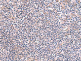Immunohistochemistry of paraffin-embedded Human tonsil tissue using GMDS Polyclonal Antibody at dilution of 1:70(×200)