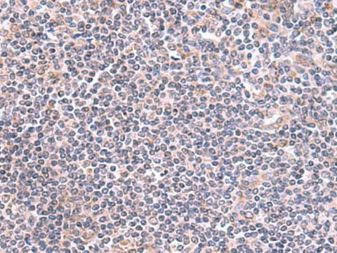 Immunohistochemistry of paraffin-embedded Human tonsil tissue using GMDS Polyclonal Antibody at dilution of 1:70(×200)