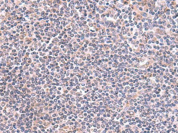 Immunohistochemistry of paraffin-embedded Human tonsil tissue using GMDS Polyclonal Antibody at dilution of 1:70(×200)