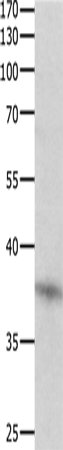 Anti-Human/Mouse/Rat DUSP12 Antibody - ABMIUM