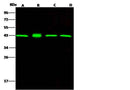 Anti-Human MAPK1 Antibody [A1007] - ABMIUM