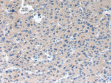 Anti-Human/Mouse/Rat RAB2A Antibody - ABMIUM