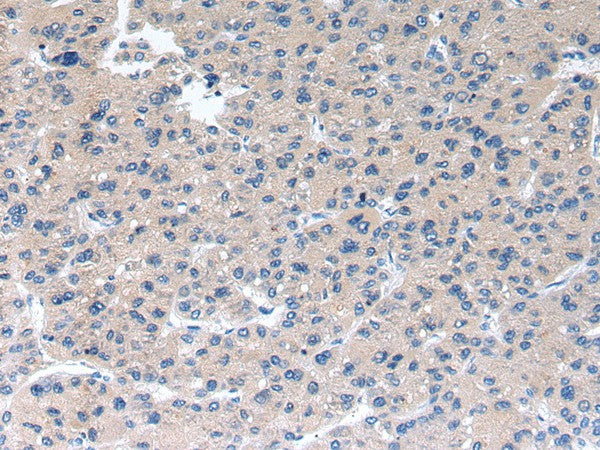 Anti-Human/Mouse/Rat RAB2A Antibody - ABMIUM