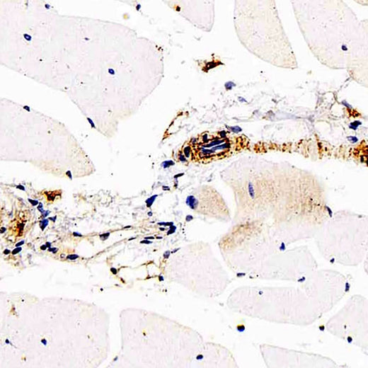 Immunohistochemistry analysis of paraffin-embedded mouse skeletal muscle using DLL4 Polyclonal Antibody at dilution of 1:200.
