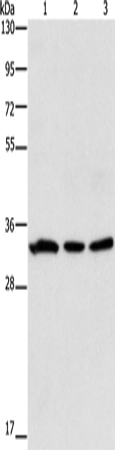 Anti-Human GPA33 Antibody - ABMIUM