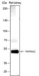 Anti-Human/Rat TMPRSS2 Antibody [A380] - ABMIUM