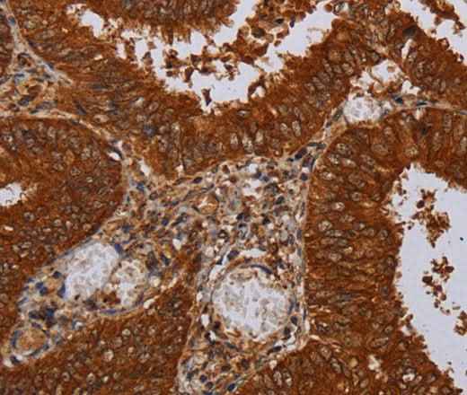 Anti-Human/Mouse/Rat MFAP3L Antibody