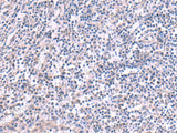 Immunohistochemistry of paraffin-embedded Human tonsil tissue using KCNK10 Polyclonal Antibody at dilution of 1:45(×200)