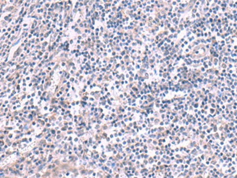 Immunohistochemistry of paraffin-embedded Human tonsil tissue using KCNK10 Polyclonal Antibody at dilution of 1:45(×200)