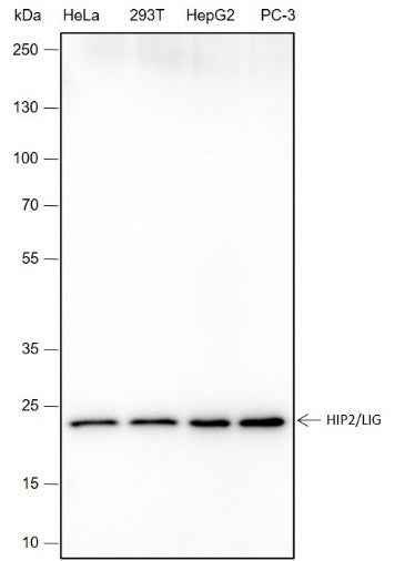 Anti-Human HIP2/LIG Antibody [A412] - ABMIUM