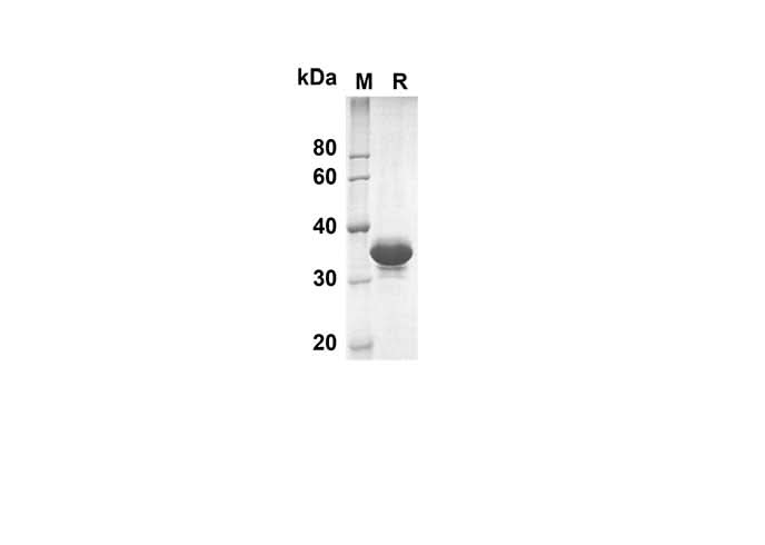 SDS-PAGE analysis of Human DAND5 proteins, 2 μg/lane of Recombinant Human DAND5 proteins was resolved with SDS-PAGE under reducing conditions, showing bands at 38.2 kDa.