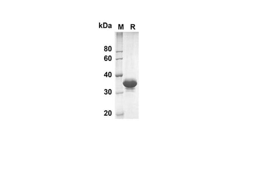 SDS-PAGE analysis of Human DAND5 proteins, 2 μg/lane of Recombinant Human DAND5 proteins was resolved with SDS-PAGE under reducing conditions, showing bands at 38.2 kDa.