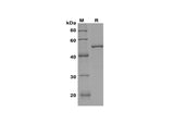SDS-PAGE analysis of Human STAT6 proteins, 2 μg/lane of Recombinant Human STAT6 proteins was resolved with SDS-PAGE under reducing conditions, showing bands at 52 kDa.
