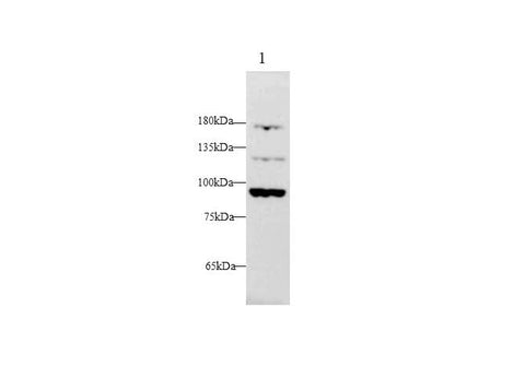Anti-Human FGA Antibody - ABMIUM