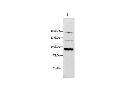Anti-Human FGA Antibody - ABMIUM