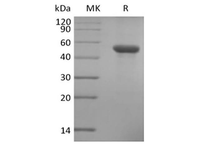 Recombinant Human ILDR2 (C-6His) - ABMIUM