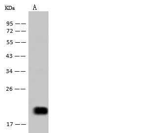 Anti-Human IL5 Antibody [B207] - ABMIUM