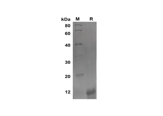 SDS-PAGE analysis of Mouse CXCL10 proteins, 2 μg/lane of Recombinant Mouse CXCL10 proteins was resolved with SDS-PAGE under reducing conditions, showing bands at 12 kDa.