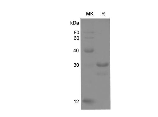 SDS-PAGE analysis of Rat Lamin B1 proteins, 2 μg/lane of Recombinant Rat Lamin B1 proteins was resolved with SDS-PAGE under reducing conditions, showing bands at 25.4 kDa.