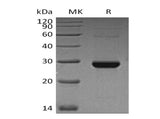 Recombinant Human TK1 Protein (His Tag) - ABMIUM