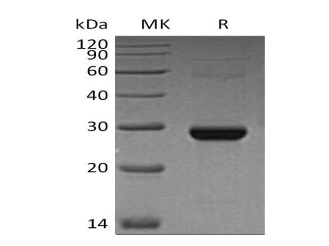 Recombinant Human TK1 Protein (His Tag) - ABMIUM