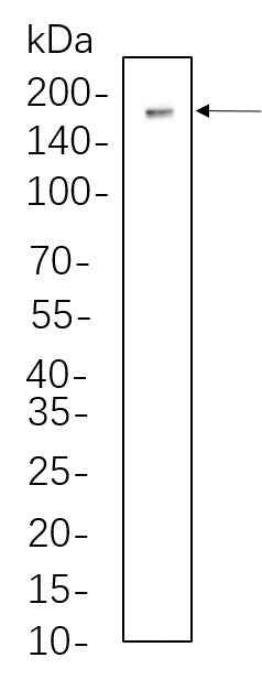 Anti-Human/Mouse/Rat DNMT1 Antibody [B781] - ABMIUM