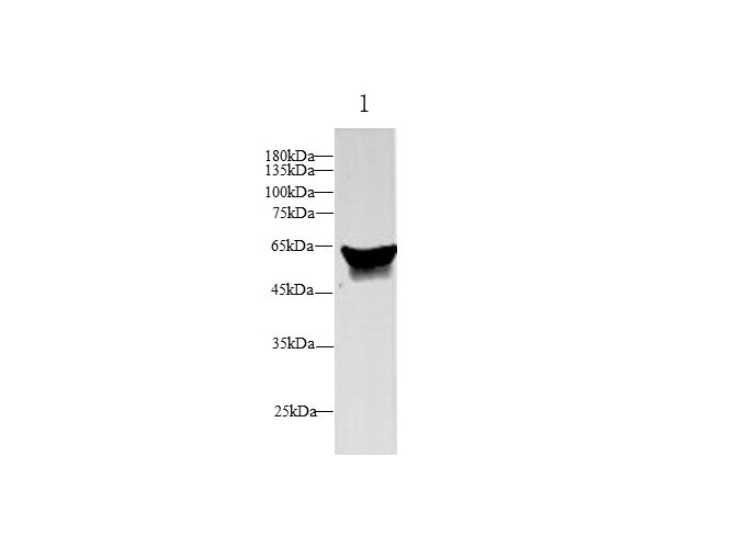 Anti-Human SERPINA6 Antibody - ABMIUM