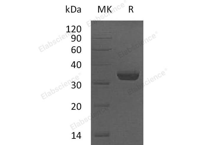 Recombinant Human LMAN2/VIP36 Protein (E.coli, His Tag) - ABMIUM