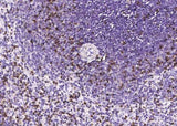 Anti-Human CD2 Antibody [A849] - ABMIUM